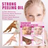 Yellow Extra Strong Chemical Peeling Oil, Chemical Peel Oil for Dark Skin, Exfoliating Peeling Solution for Body All Skin Type 110 ML/3.66 FI OZ
