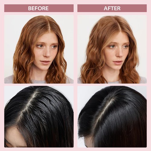 YLNALO Dry Shampoo Powder 2 Packs, Mattifying Root Fuller Looking Refreshing Hair,Non-aerosol, No White Cast, Travel Size Dry Shampoo Suitable for Women and Men,0.58Oz