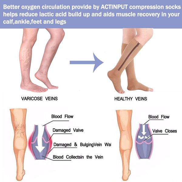 2 Pairs Compression Socks Toe Open Leg Support Stocking Knee High Socks with Zipper (Nude, L/XL) …