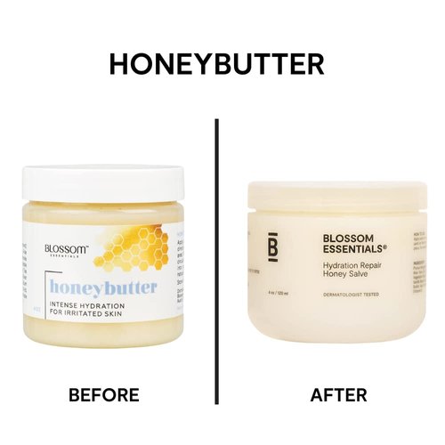 Blossom Essentials Honey Salve, Hydration Repair for Dry & Itchy Skin - Eczema & Psoriasis Relief for Sensitive Skin - Organic Manuka Honey - 4-Ounces (Formerly Honeybutter)