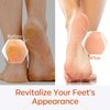modelones Callus Remover for Feet, Callus Remover Gel Foot Scrubber for Dry, Cracked & Dead Skin, Extra Strength Pedicure Foot Spa Products, Salon Grade Callus Remover, Pedicure Tools for Feet, 8.1 Oz