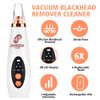 Blackhead Remover Pore Vacuum - JOREEN PLUS (UPDATED) Electric Blackhead Removal Tool Acne Extractor Facial Cleaner Suction Tools Kit for Women, Men USB Rechargeable LED Display with 6 Suction Probes.