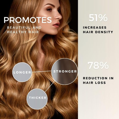 Belle Morgane Hair Growth Serum, 1 oz, Organic Hair Serum for Hair Loss & Thinning in Women & Men. Scalp-Stimulating Hair Oil for Growth & Strength, Suitable for All Hair Types