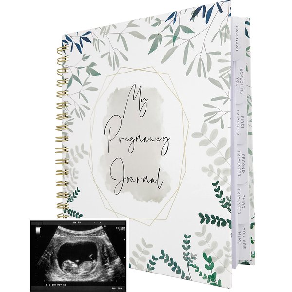 Pregnancy Journal Memory Book for Expecting Moms - Calendar for Pregnancy Planner - Weekly Monthly Organizer to Track Milestones - Hardcover with Keepsake Pocket - Gift for First Time Moms