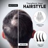ELEVATE Hair Fibers for Thinning Hair (BLACK) 100% Natural & Undetectable Keratin Hair Fibers to Instantly Thicken Thinning & Balding Hair in 30 sec for Men & Women - Natural Hair Loss Concealer 28g