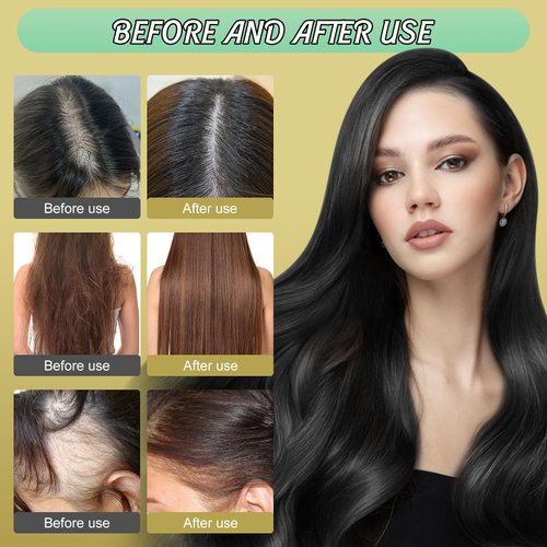 3PCS Ginger Plant Extract Anti-Hair Loss Hair Shampoo, Ginger Extract Shampoo From Japan, Polygonum Multiflorum Oil Control Anti-Dandruff Shampoo, Southeasty Japanese Shampoo 240ML /PCS