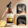 Ginger Hair Growth Essence - Anti-Hair Loss Treatment and Extract Oil