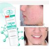 AICHUN BEAUTY Anti-Acne Cream Treats Pimple Clogged Pores Oil Control Reduces Acne Scars Shrinks Pores 20g / 0.68fl.oz
