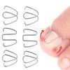Ingrown Toe Wire Fixer, Nail Corrector Ingrown Tool Brace for Nail Toe Straighteners Braces Foot Care Men Women