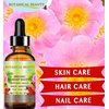 Botanical Beauty ORGANIC ROSEHIP SEED OIL Pure For Face, Skin, Hair and Body. Anti-Aging Moisturizer Facial Oil 2 Fl oz 60 ml