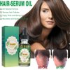 Dash Hair Growth Oil – Advanced Rosemary Oil for Hair Growth – Unique Blend of Hair Oil for Dry Damaged Hair and Growth – 7+ Hair Oils for Hair Growth, Volume, Strength – 60ml