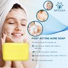 Natouch Acne Treatment Soap Bar, Antifungal Medicated Soap Bar, Acne Body Wash with Salicylic Acid, Acne Scars and Dark Spot Remover with Natural Essential Oil for Face, Body, Back, and Butt