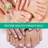 3PCS Kerassentials Toenail Treatment Oil, Natural Kerassentials Toenail Oil for Nails, Kerasentials Toenail Nail Treatment for Repairing Damaged and Discolored Nails (30ml)