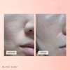 BLANC DUBU NUBORN CELL Hydrogel Collagen Mask | Advanced Stem Cell Hydrogel Sheet Face Mask for Dry Skin | 2% Niacinamide, Hydrolyzed Collagen, Peptides and Hyaluronic Acids | Made in Korea 4-Pack