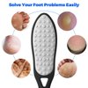 Pedicure Foot File Callus Remover for Feet, Double-Sided Colossal Pedicure Tools, Metal Surface Foot Scrubber, Stainless Steel Foot RASP, Dead Skin Exfoliator for Feet
