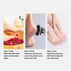 Electric Callus Remover Removable Washable Adjustable USB Interface Electric Foot Callus Remover Electronic Foot File for Hard Cracked Dry Skin