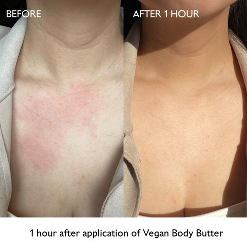 Caudalie Vinotherapist Replenishing Vegan Body Butter with Shea Butter and Grape-seed Oil, Addresses Itching Caused by Eczema and Other Skin Conditions