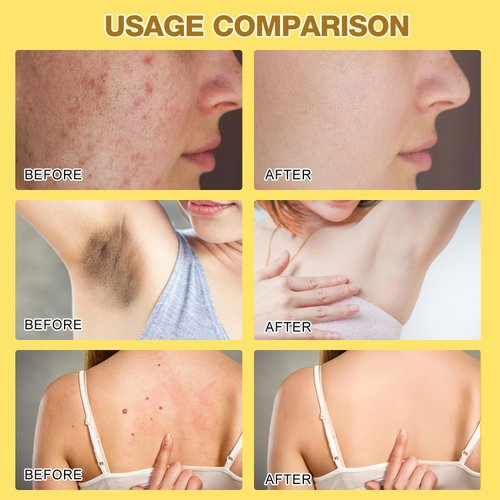 2pcs Bee Venom Treatment Cream, New Professional Bee Venom Repair Cream, Bee Venom Cream for All Body Parts