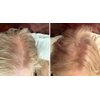 Hair Building Fibers. Cover Bald Spot and Thinning Hair. All-Natural, Plant-Based (Trial Size, 10-Day Supply). Golden Blonde