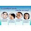 CLERZENA Clear Pimple Patches for Face - Hydrocolloid Acne Patches Salicylic Acid Tea Tree Oil Calendula Oil – Acne Patch Zit Stickers - Acne Dots for Skin Care