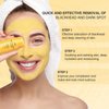 Turmeric Clay Stick Mask, Organic, Vitamin C Purifying Mask for Blackhead Cleansing, Healing, Clay Mud Mask for Deep Clean Pore, Improve Skin Acne Scars Facial Mask With Blackhead Remover Extractor ToolS