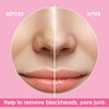 JOLVKA Blackhead Remover Pore Strips for Nose - 65 Strips - Charcoal Blackheads Removal - Blackhead Strip - Pore Cleaner
