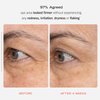 First Aid Beauty Retinol Eye Cream with Squalane + Ceramides – Visibly Smooths Fine Line & Wrinkles Around the Eyes – 0.5 oz.