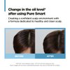 AMOS PROFESSIONAL Pure Smart Peeling l Scalp Treatment for Oily & Flaky Scalp l Deep Cleansing, Scalp Exfoliator l 0.67 fl.oz X 4ea