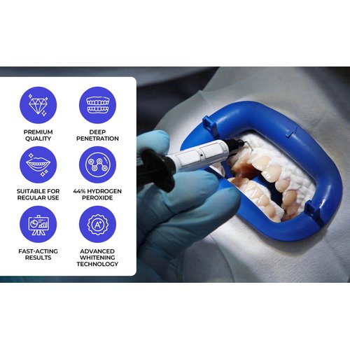 LaserGlow Professional Teeth Whitening Gel 44% Hydrogen Peroxide – Dual Barrel Syringe for Fast, Effective, and Whitening Results | Hydrogen Peroxide Gel, Teeth Whitener, Tooth Whitening Gel