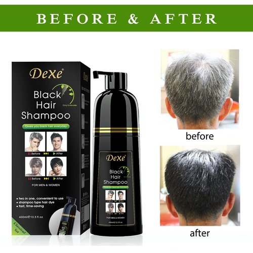 Dexe Hair Dye Shampoo 13.5 Fl Oz, Semi-Permanent Black Hair Dye, Hair Color Shampoo, Black Hair Shampoo For Men & Women, Mild Plant Formula Black Hair Dye Shampoo, 100% Gray Coverage (black)
