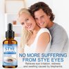 Stye Eye Treatment, Eye Stye Remover Drops, Gentle Relief for Chalazions, Blepharitis, Eyelid Bumps, Natural & Non-Irritating, Fast Acting Soothing, 30ml