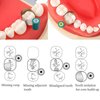Windplusya Dental Double-Side Contoured Anatomically Shaped Matrix Bands, Adjustable Dental Matrices Matrix Bands, 0.03/0.038mm Knob Type Matrix (Yellow, 5mm)