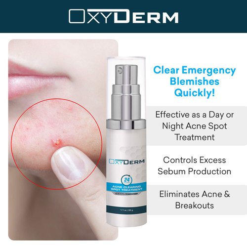 Acne Spot Treatment- Overnight Pimple Treatment for All Skin Types without Over Drying your Skin. Removal for Inflamed Blackheads, Whiteheads, Cystic Acne. Results within Hours for Adults & Teens.
