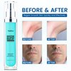 Sielkin Ingrown Hair Treatment: Razor Bumps Stopper for Women and Men Upgraded Formula