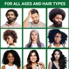 Seddy Hair Growth Oil - Caffeine, Castor, Biotin, Peppermint, Argan, Jojoba, Rosemary Oil for Hair Growth- Longer, Thicker, Fuller Hair treatment Oil for Hair loss & Damaged Hair-1.7 Fl. Oz(Pack of 1)