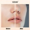 Facial Hair Removal for Women, SEIHAI Hair Removal Device(2023), Rechargeable Hair Remover for Women, Facial Hair Remover for Face, Upper Lip, Chin, Included 2 x Replacement Heads