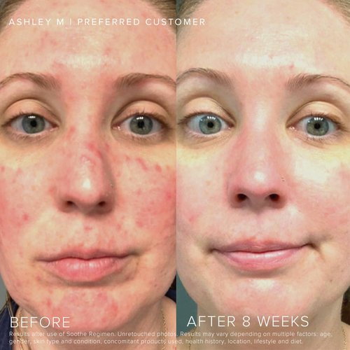 RODAN + FIELDS Soothe Sensitive Skin Treatment | 50 ml | Daily Face Moisturizer | Ideal for Dryness, Irritation & Redness | Lightweight Formula