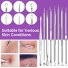15 PCS Pimple Popper Tool Kit,Blackhead Remover Comedone Extractor Tools,Professional Pimple Comedone Extractor,Stainless Steel Skin Blemish Removal Acne Tools for Forehead Nose Face with Metal Case