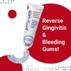 Perio Care Gel for Trays (1 Tube + 2 Trays) - 1.7% Hydrogen Peroxide Gel - Compare to Perio Gel, Perio Gel X, Perio Protect Gel, GumX Defender Plus Gel, Perio Daily Defense Gel & Perio Restore Gel