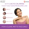 Lacto Calamine Daily Face Moisturizing Lotion for Oily Skin, 4.06 Fl Oz (120 ml), for Pimples, Acne, Dark Spots, and Blackheads