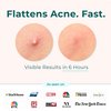 CLEOF Pimple Patches for Face & Body - Overnight Treatment - Acne Patch for Zits, Dots, Bumps, Spots, Pimples, Whiteheads - Hydrocolloid Stickers - Vegan, Cruelty-Free, Hypoallergenic (10mm)
