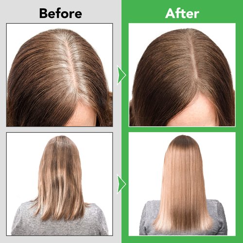 AGETITY Hair Mask, Rosemary Essential Oil Hair Mask for Color Treated Hair Dry, Rosemary Hair Repair Treatment for Damaged Hair, Deep Hair Treatment for Bleached Hair