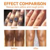 Dark Knees Remover Underarm Cream Body Moisturizer Lotion Dark Toe Knuckles Treatment Removal Remover Corrector for Armpit Elbow Inner Thigh Neck Private Part Intimate Legs Skin Cream - 120g/4.21oz