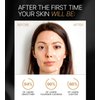 Premium 24K Gold Sheet Mask for Men & Women - Moisturizing Collagen Face Mask Set & Hydrating Face Masks Skin Care - Korean Beauty Skin Care Face Mask - Gold Collagen Facial Mask Sheet 1 pack (5)