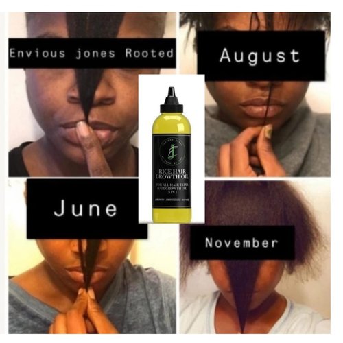 Rice Hair Oil 3 in1 growth moisturize repair alopecia edges beard hair loss hot oil treatments. for Hair Growth, Eyelashes and Eyebrows balding crowns bald spots 4oz fl