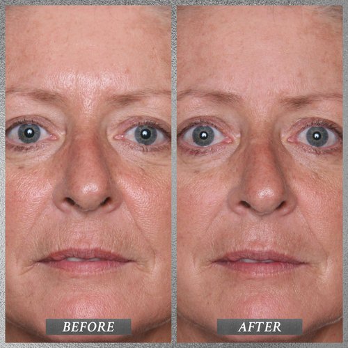 PRAI Beauty Platinum Firm and Lift Creme, Firming and Hydrating Face Moisturizer for Dry Skin and All Skin Types, Face Moisturizer for Skin Firming and Lifting, 1.7 Oz