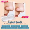 MEDca Deep Cleansing Blackhead Pore Strips - Pack of 24 Peel - Off Blackhead Remover and Pore Unclogging Strips for Nose and Face, Chin, Forehead & Healthier Looking Skin