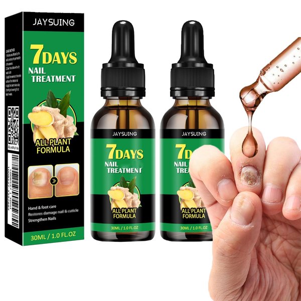 Ginger Nail Treatment Nail Support Nail Care, 7days Nail Treatment, Ginger Nail Growth Serum, Ginger Cuticle Care Oil for Nails,Cuticle Serum for Nails (2Pcs, 1 Fl.oz(pack of 1))