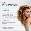 Nioxin Scalp Recovery Anti-Dandruff Moisturizing Conditioner for Itchy & Flaky Scalp, Pyrithione Zinc, 33.8 oz