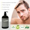 Sent From Earth Ketoconazole Caffeine Saw Palmetto Anti-Dandruff Antifungal for Psoriasis Itchy Scalp Vegan Cruelty-Free Natural Shampoo Made in USA (SHAMPOO/CONDITIONER, SET)